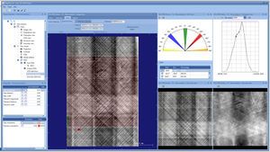 Analysesoftware