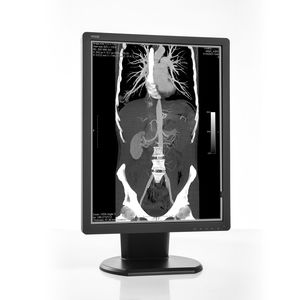 LED ATC display