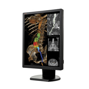LED ATC display